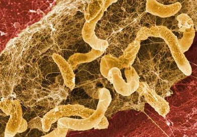 Biofilm-of-Desulfovibrio-desulfuricans