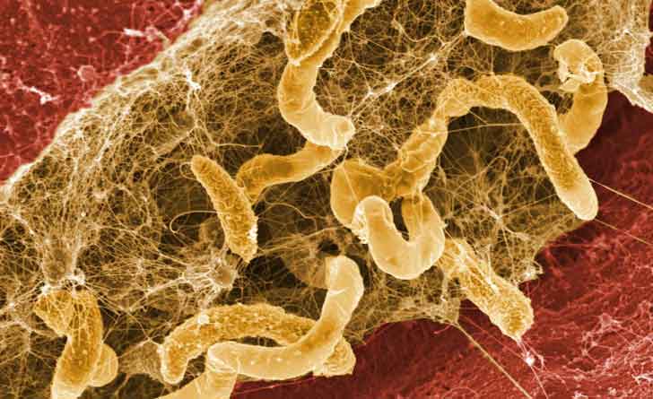 Biofilm-of-Desulfovibrio-desulfuricans